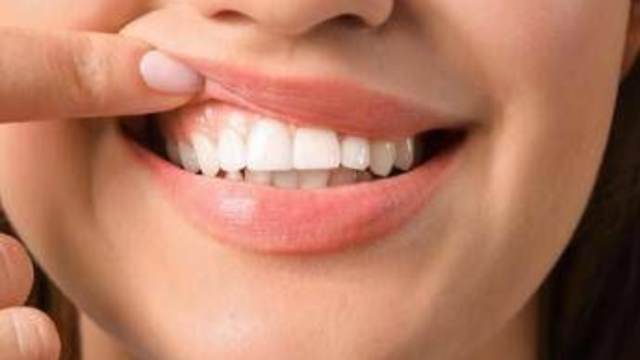 Salute 'in 70% persone con autismo problemi a denti e gengive', parodontologi in campo