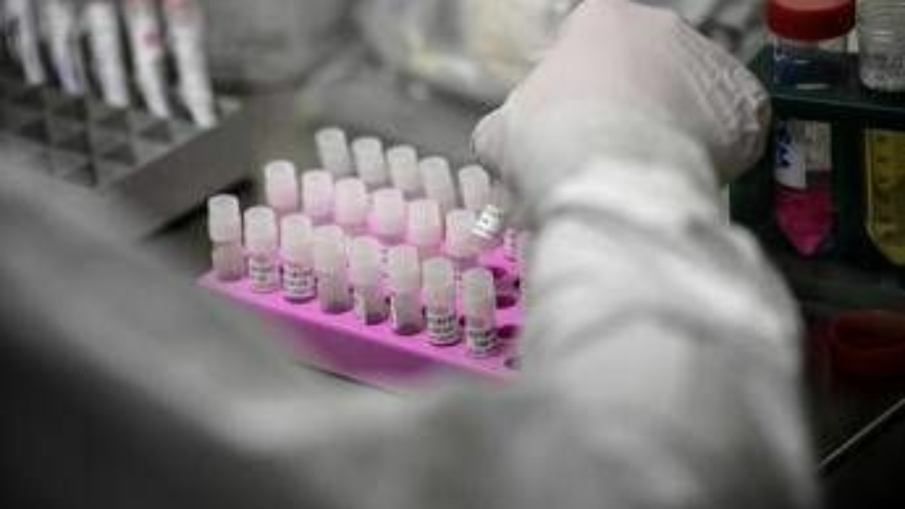 Rischio Long Covid, scoperta variante genetica che lo aumenta del 60%