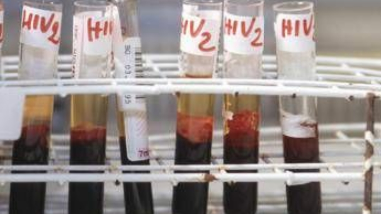 Salute, da Hiv a infezioni sessuali lotta a sommerso, al via settimana europea test