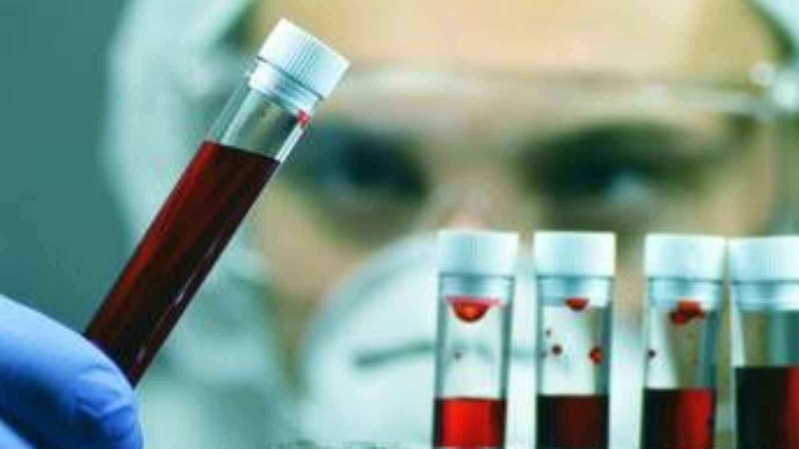 Tumori, Ue approva terapia per adulti con leucemia linfatica cronica refrattaria