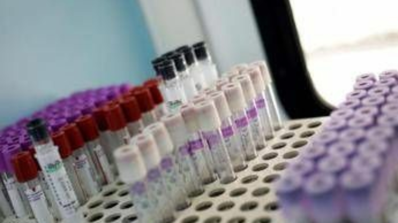 Mielofibrosi, speranze da nuovo farmaco che limita l'anemia in 2 pazienti su 3