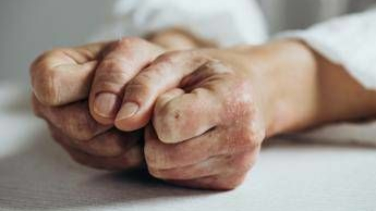 Lo studio, inibitore Il-23 riduce segni e sintomi artrite psoriasica attiva
