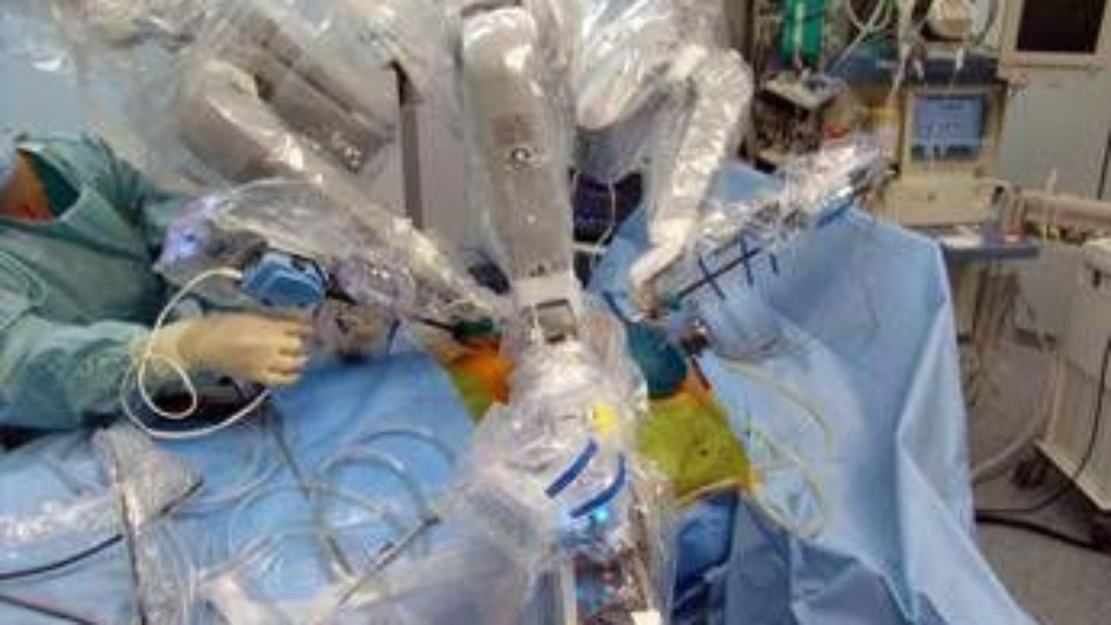 Il trapianto di pancreas entra nel futuro tra robot, staminali e nuovi anti-diabete