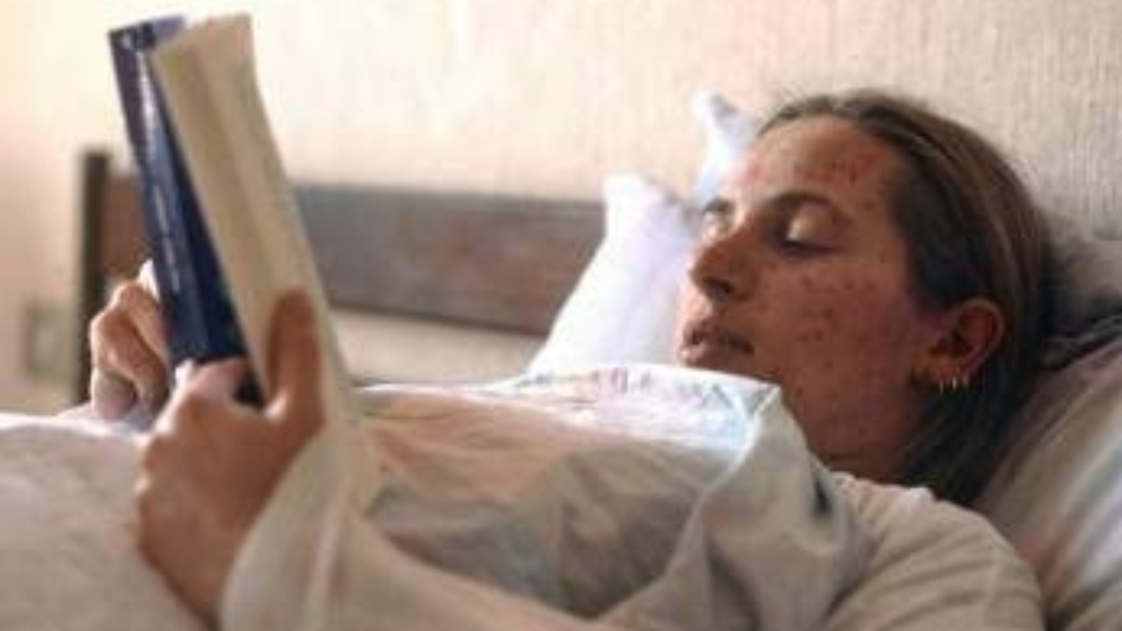 Morbillo, casi raddoppiati da aprile a maggio: "Dato preoccupante"