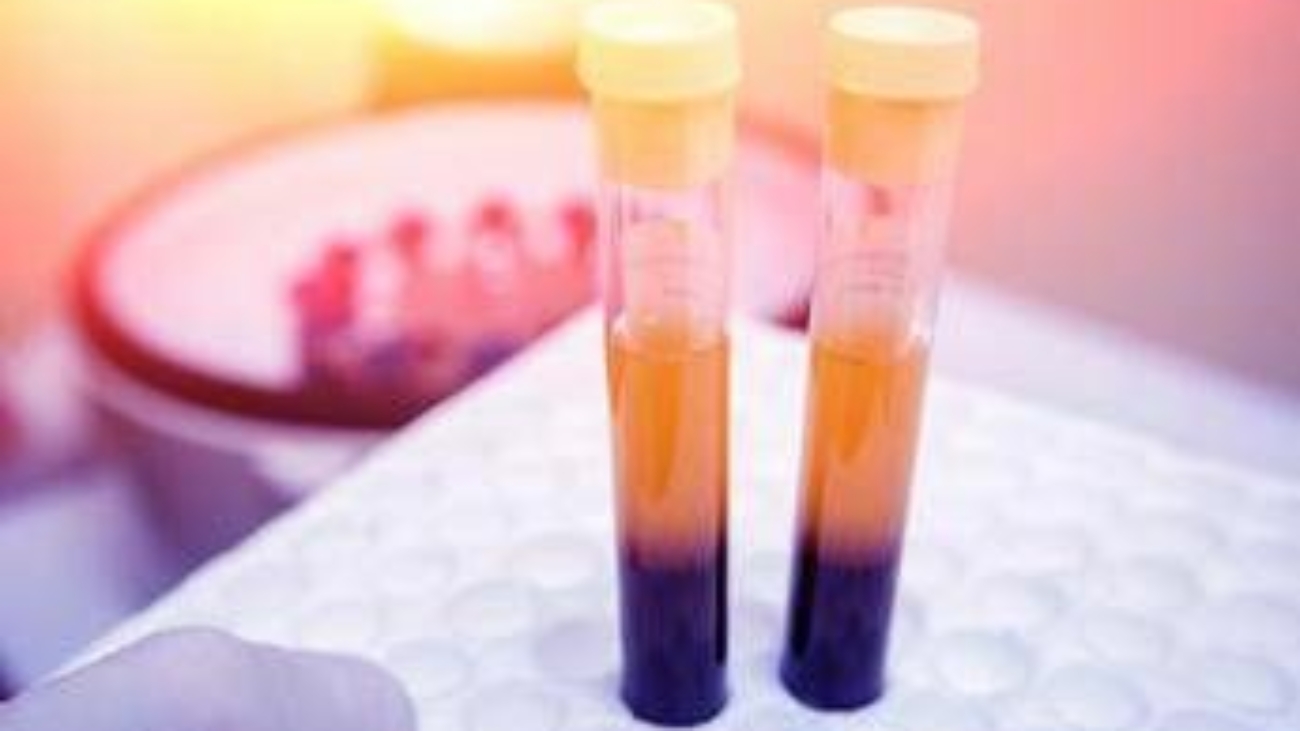 Farmaci, Sava (Sif Magazine): "In plasmaderivati attenzione particolare a sicurezza"
