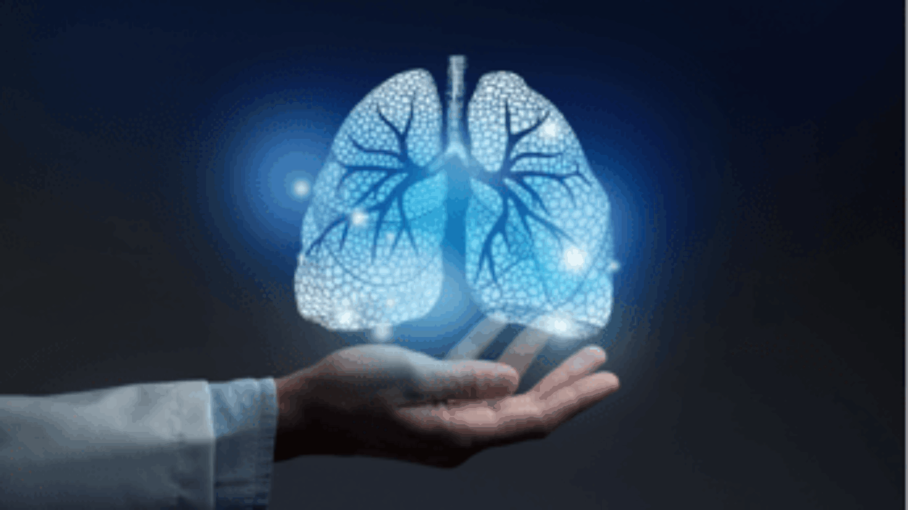 Tumori, Fondazione Fonicap: "Lung unit per tutti i pazienti con cancro polmone"