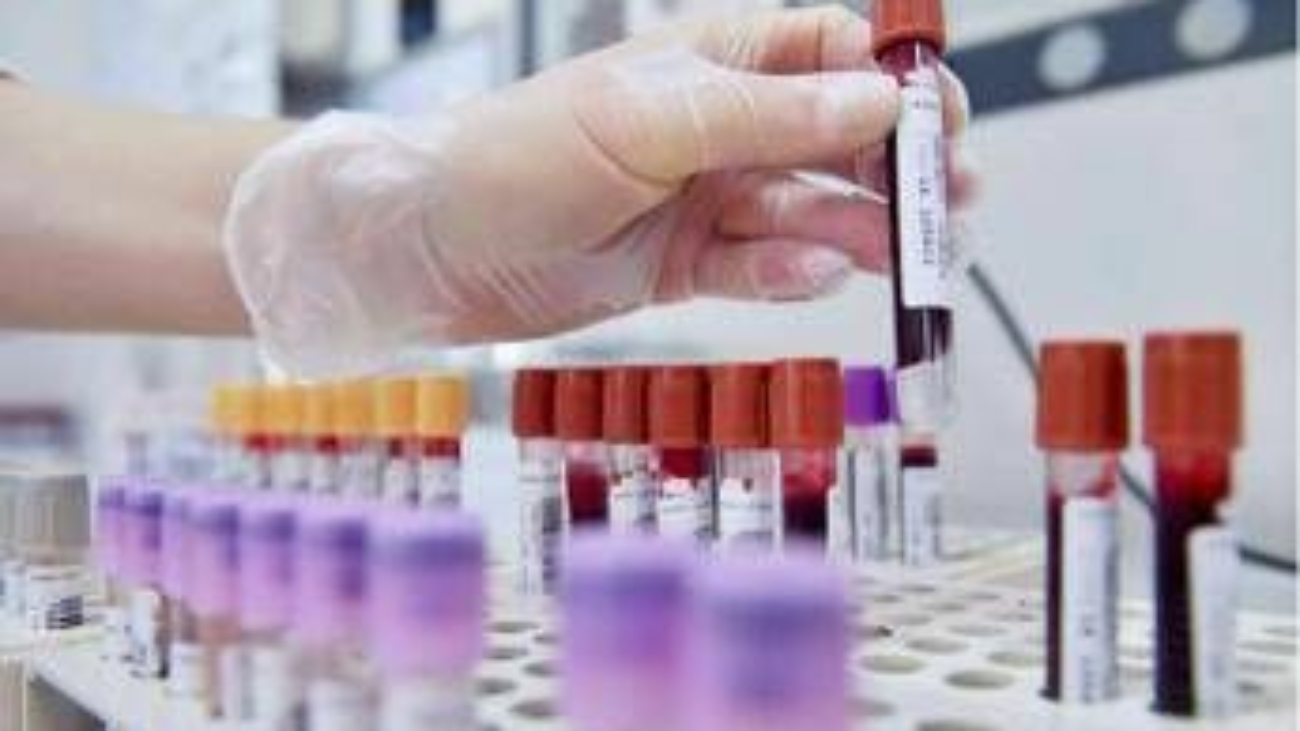 Tumore alla prostata, novità nelle terapie dei casi più gravi