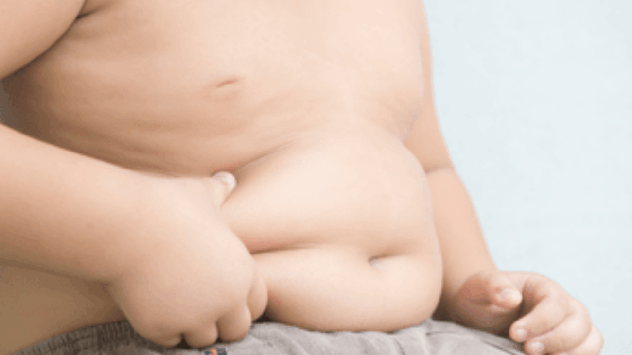 Salute, test genetico predice obesità nei bimbi under 5: maxi-studio internazionale