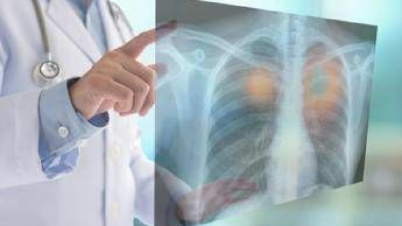 Fine vita, oncologi: "No a Comitato nazionale e a esclusione Ssn, subito confronto"