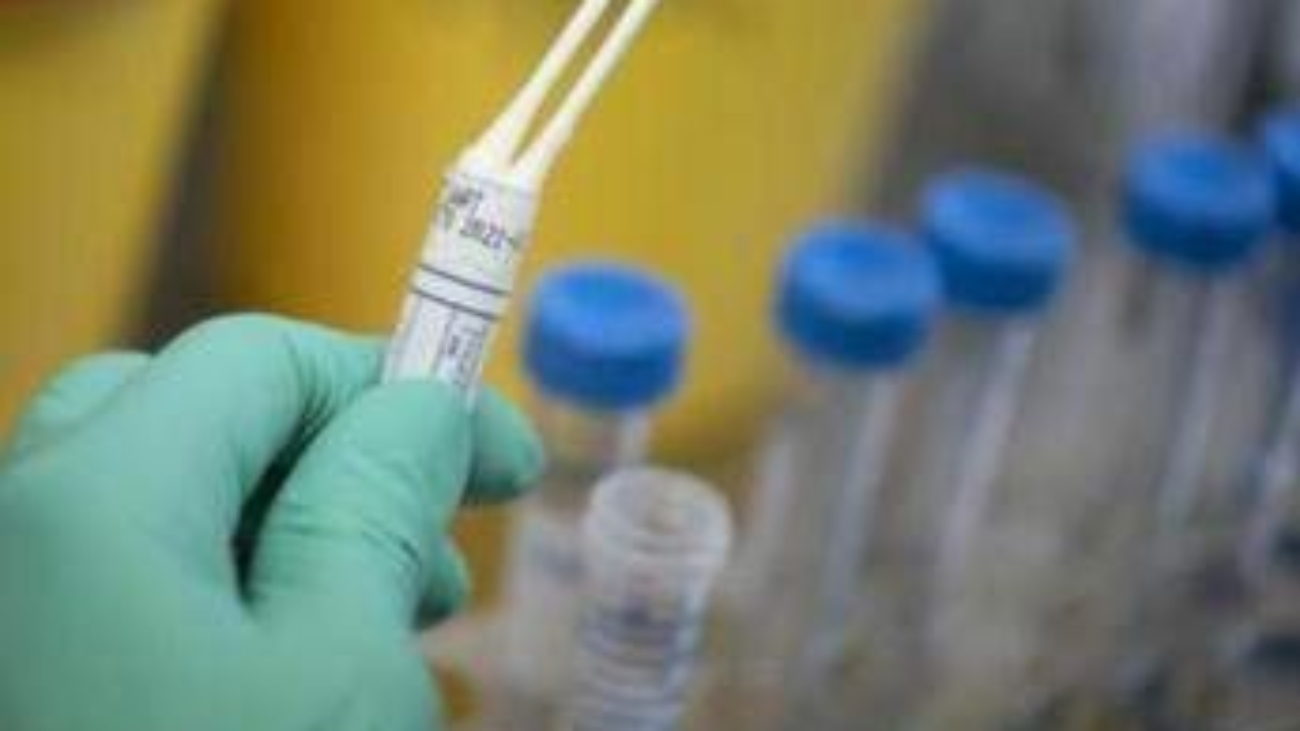Legionella in case popolari a Milano, un morto e diversi ricoverati