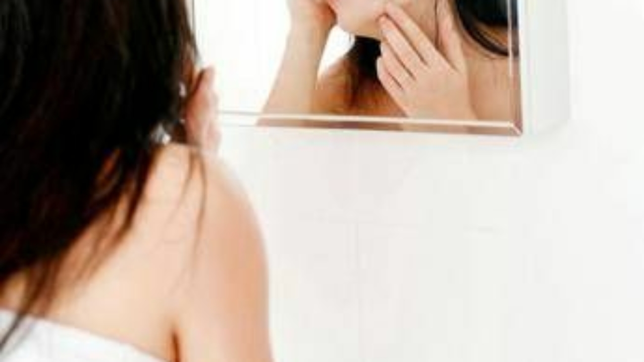 Sos 'acne shaming', 2 persone su 5 bullizzate per l'aspetto della pelle