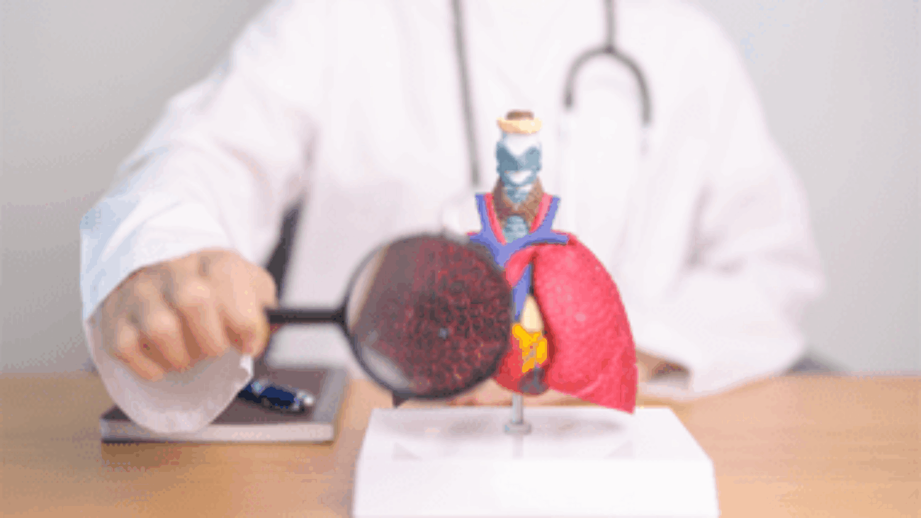 Fibrosi cistica, Aifa rinnova e amplia anche a bimbi rimborsabilità trattamenti