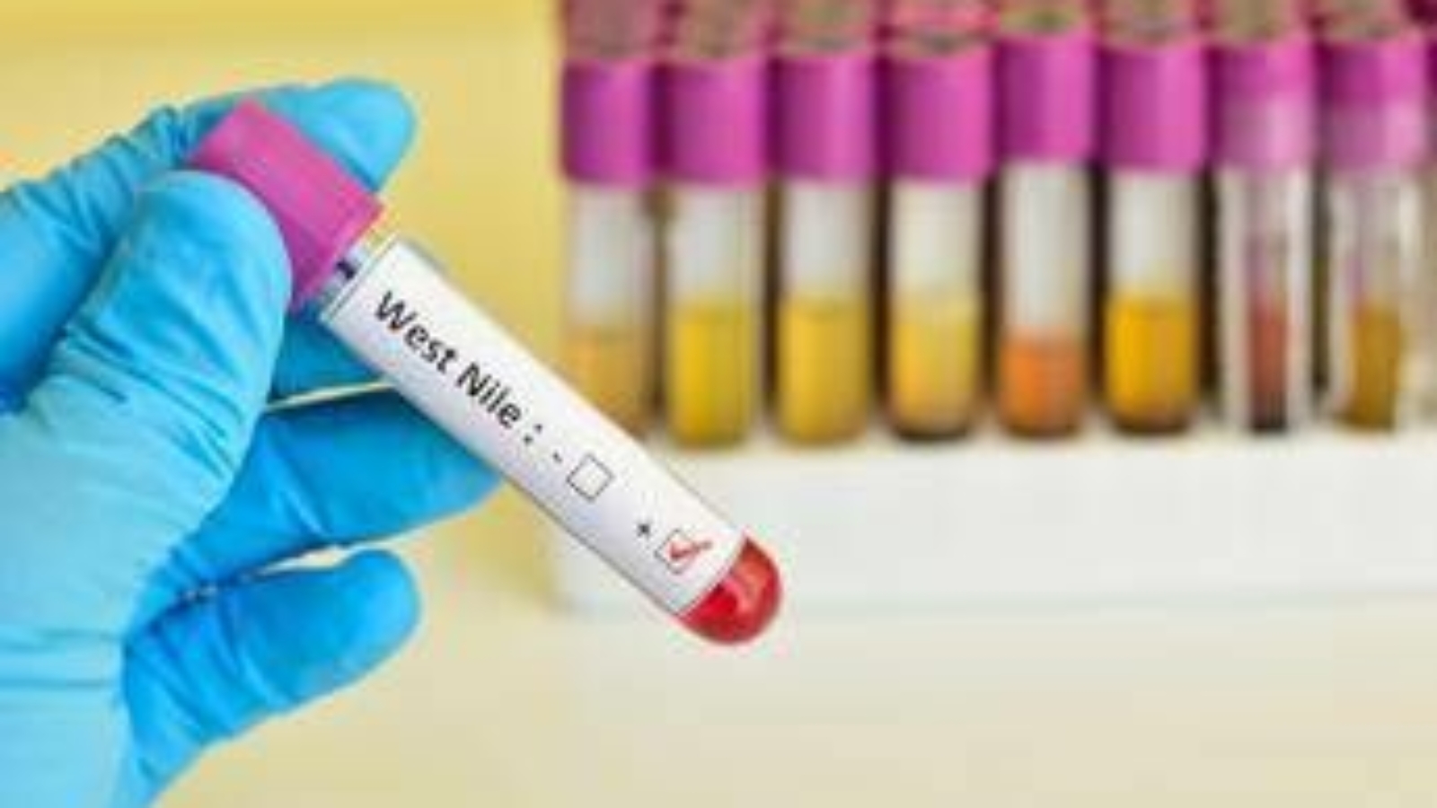 West Nile, Italia al primo posto in Europa per casi nell'uomo: il report Ecdc