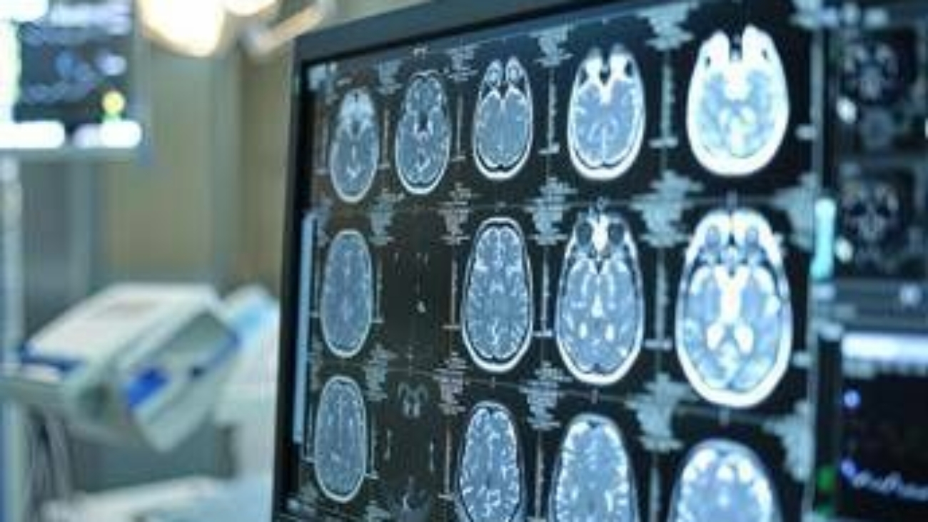 Giornata mondiale dell'Alzheimer, neurologi: "Ora percorsi cura più efficaci e sostenibili"