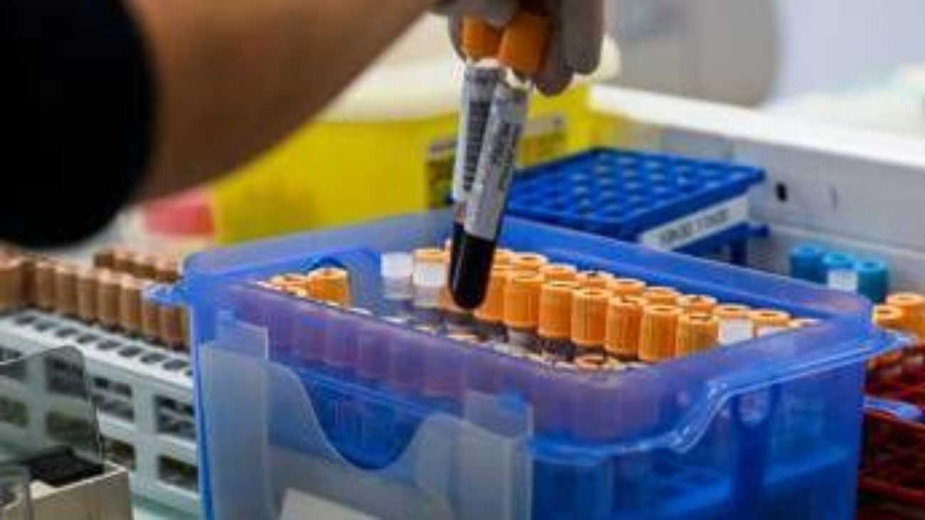 Fegato, un test per scoprire il rischio di gravi malattie entro 10 anni: lo studio