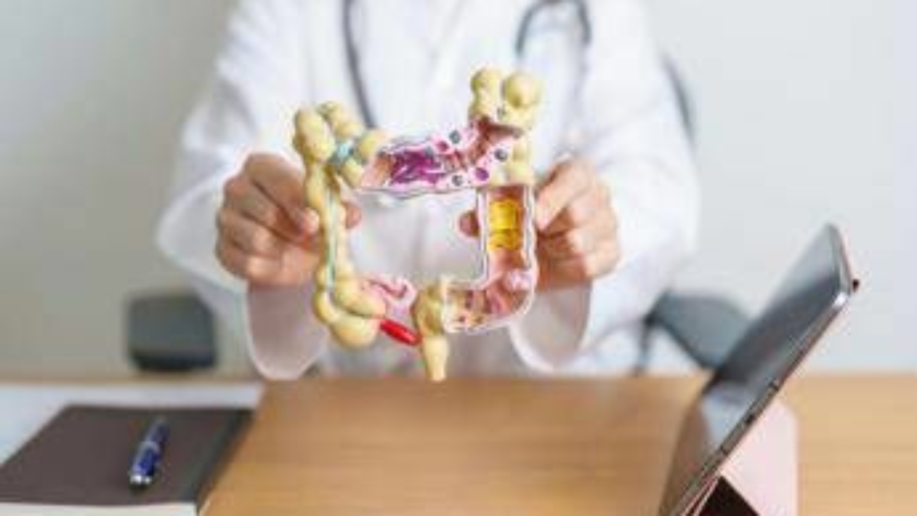 Cancro al colon, microbioma può predirne rischio e guidare diagnosi precoce