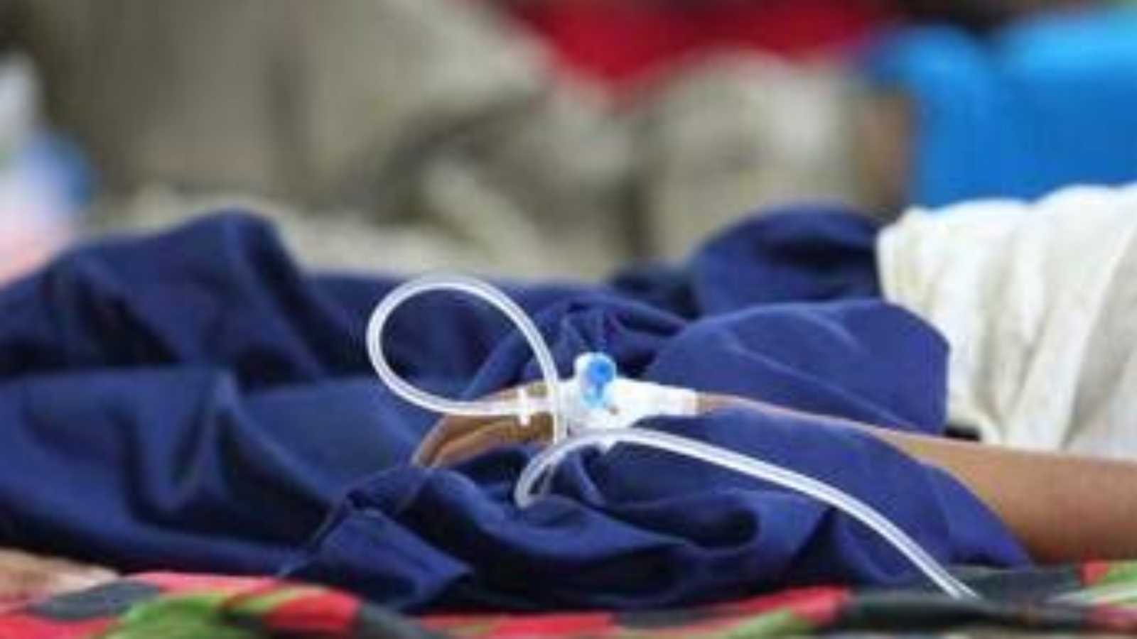 Lotta al melanoma, l'immunoterapia funziona meglio al mattino