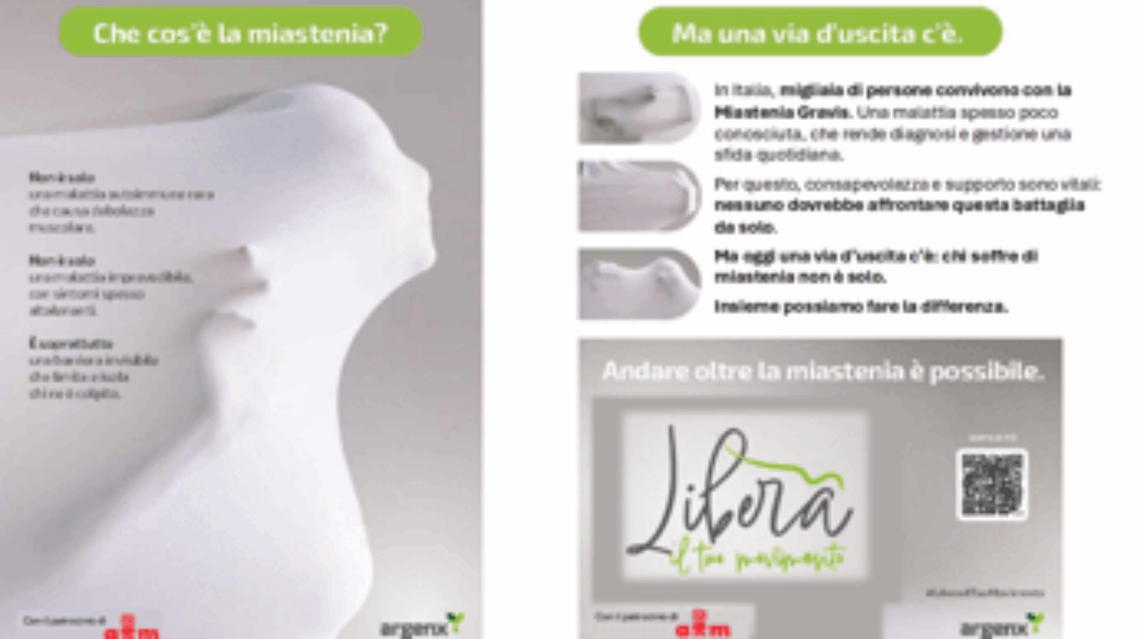 Miastenia grave, a Milano la danza accende riflettori sulla patologia