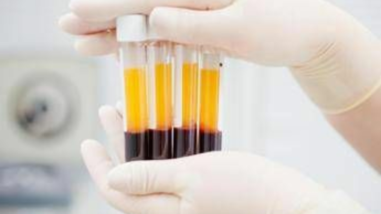 Manovra, Associazione immunodeficienze primitive: "Agire su plasmaderivati"