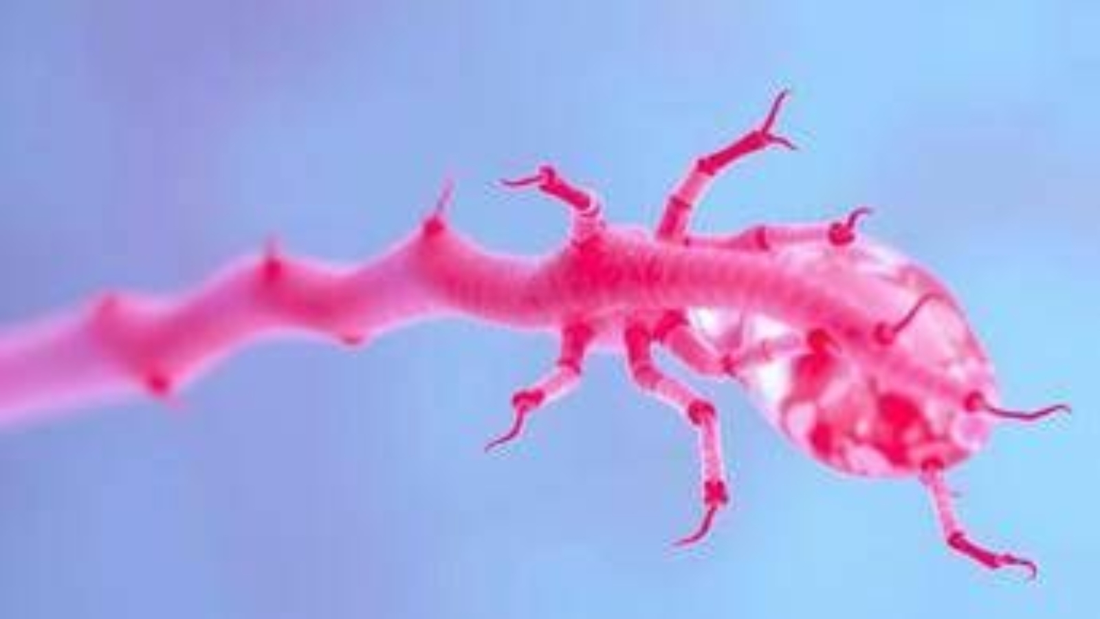 Miastenia, in Sardegna su mille pazienti stimati solo metà nel registro