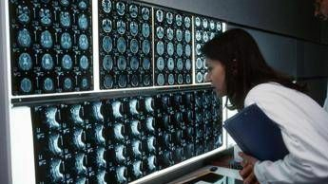 Cancro, 4 sintomi 'insoliti' che bisogna conoscere: parola di oncologo