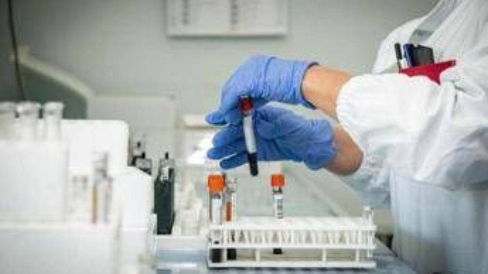 Epatite A, crescono i casi: sesso e alimenti, come si prende e sintomi