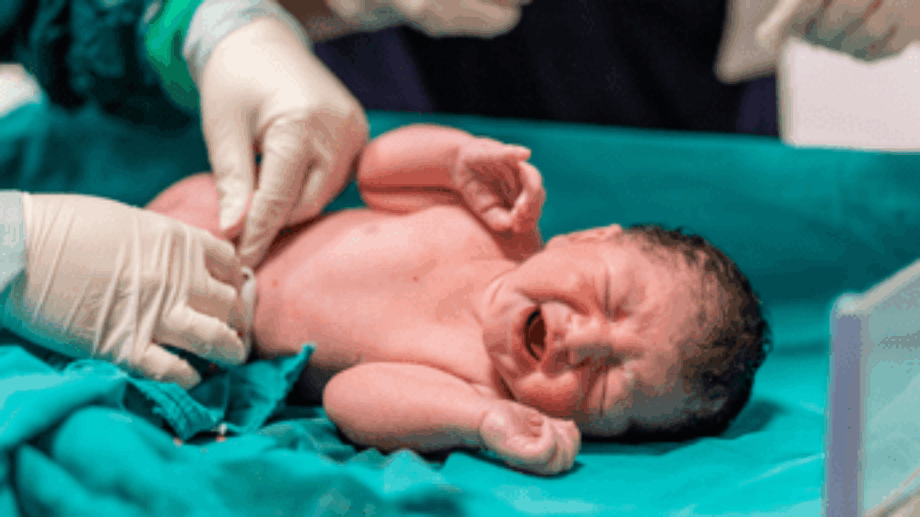 Sangue cordonale, meno del 3% delle coppie in Italia sceglie di donarlo