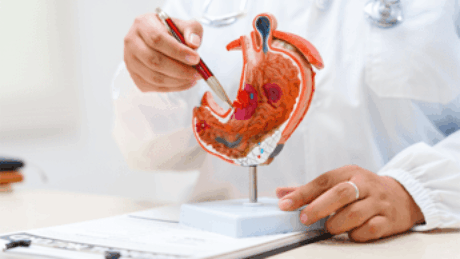 Tumore allo stomaco, pazienti: "Diagnosi precoce per meno di 1 su 5, migliorare percorsi"