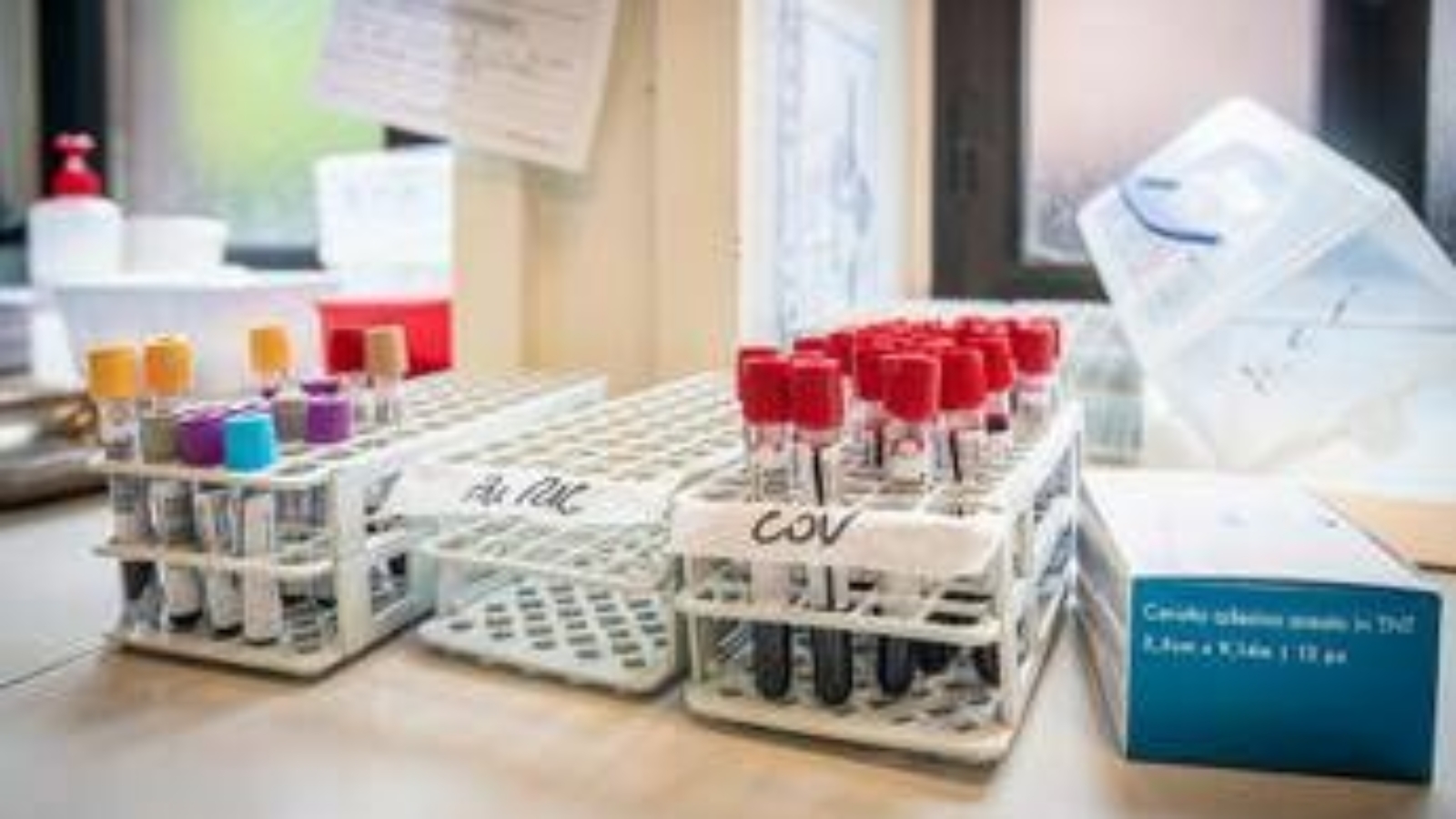 Medicina di laboratorio, 'un semplice esame per scoprire in anticipo le patologie'