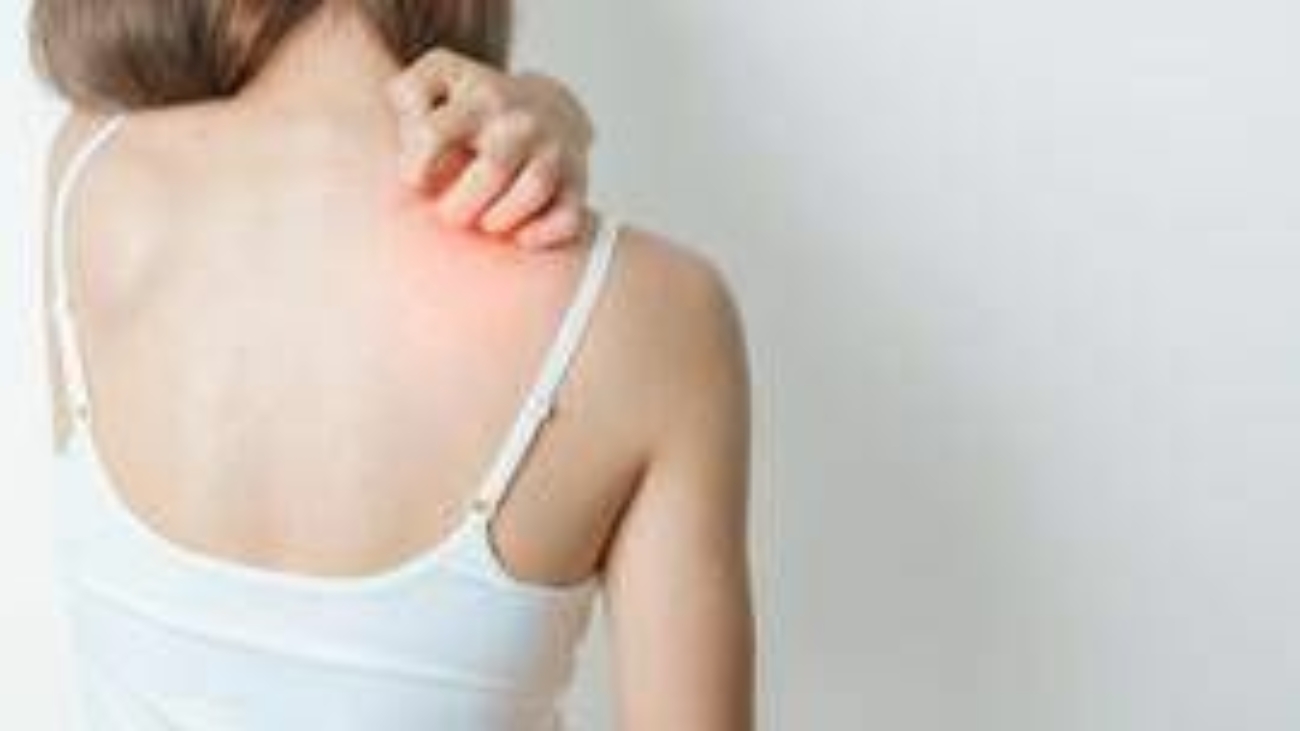 Farmaci, via libera in Europa ad anifrolumab penna pre-riempita per cura Les