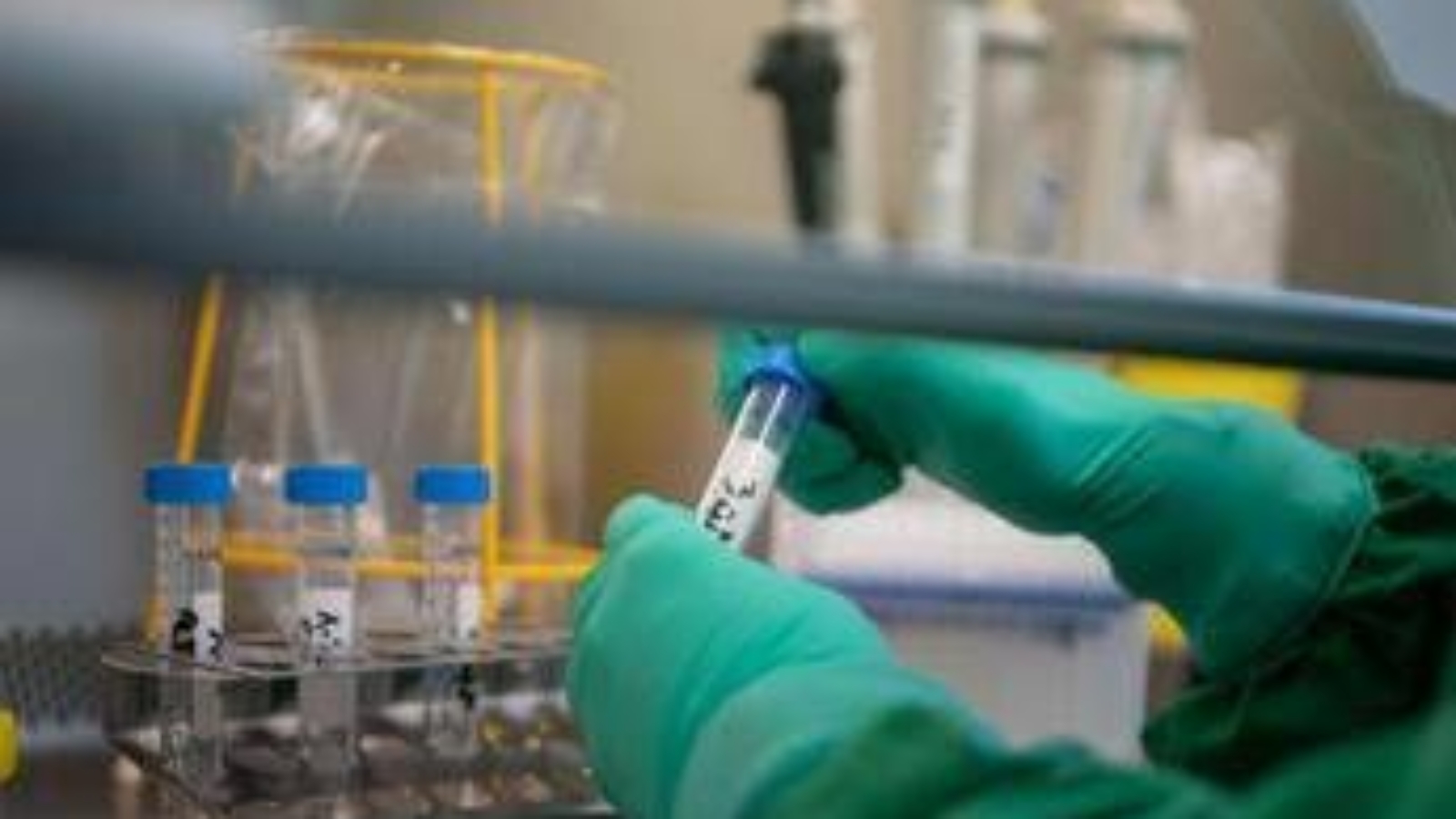 Prostata, svelata la rotta segreta delle infezioni: la scoperta rivoluzionaria