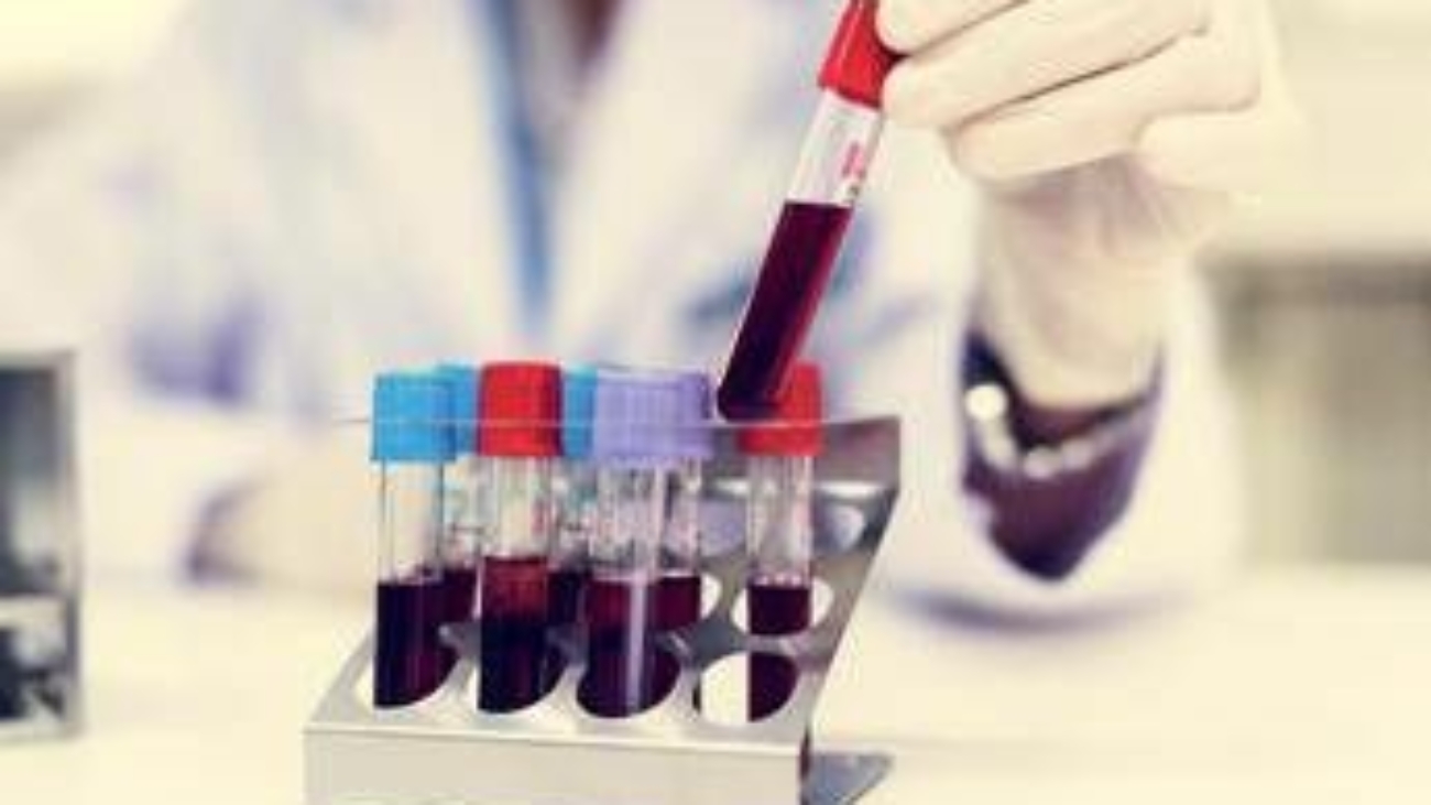 Come vivere più a lungo? Il test del sangue svela la longevità