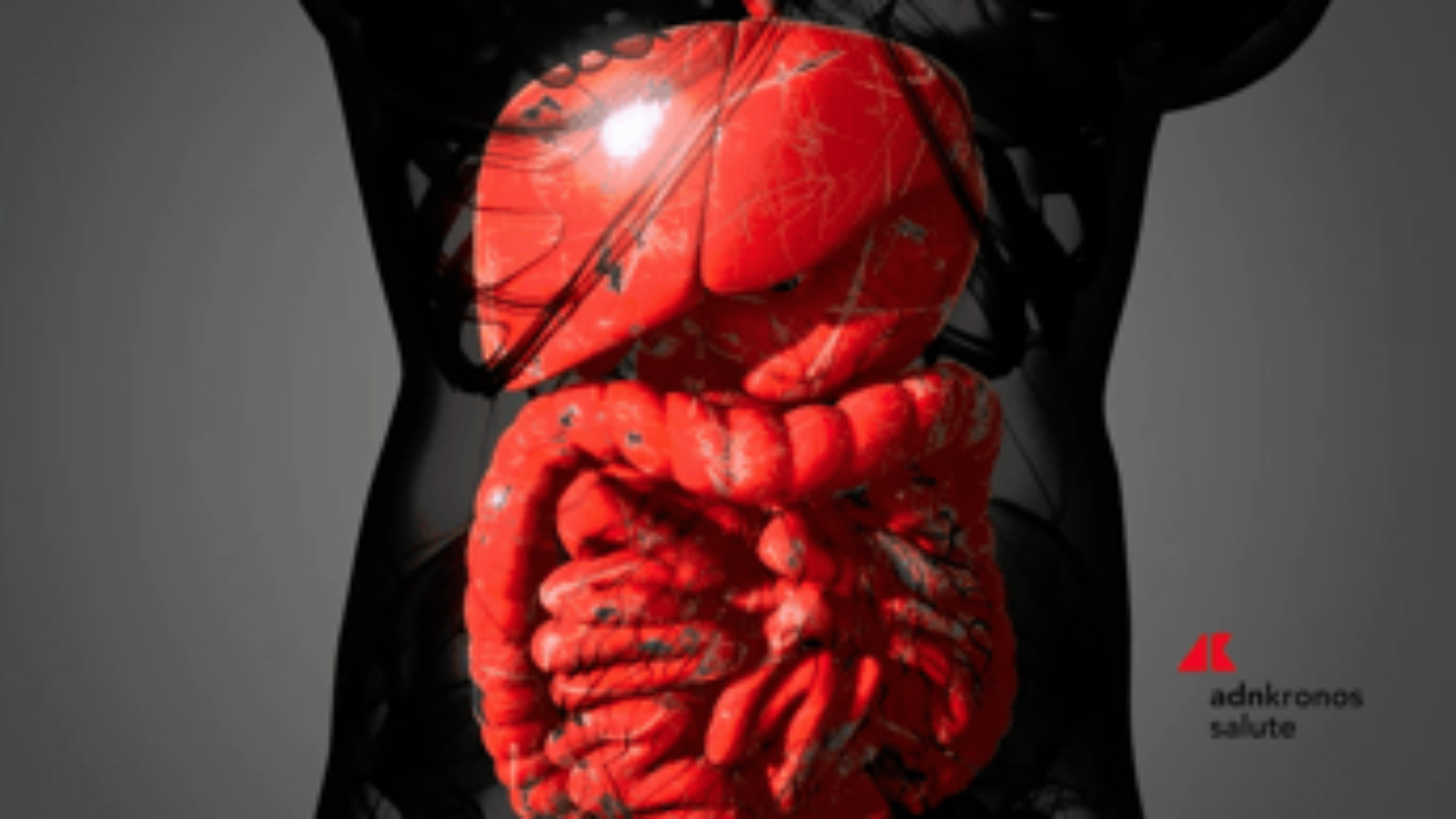 Malattia di Crohn, solo 1 paziente su 3 riceve supporto nutrizionale