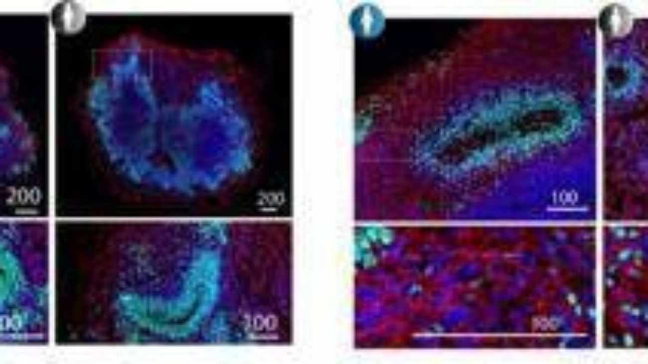 Studio italiano, 'la Sma colpisce dall'embrione, cruciali screening e cure precoci'