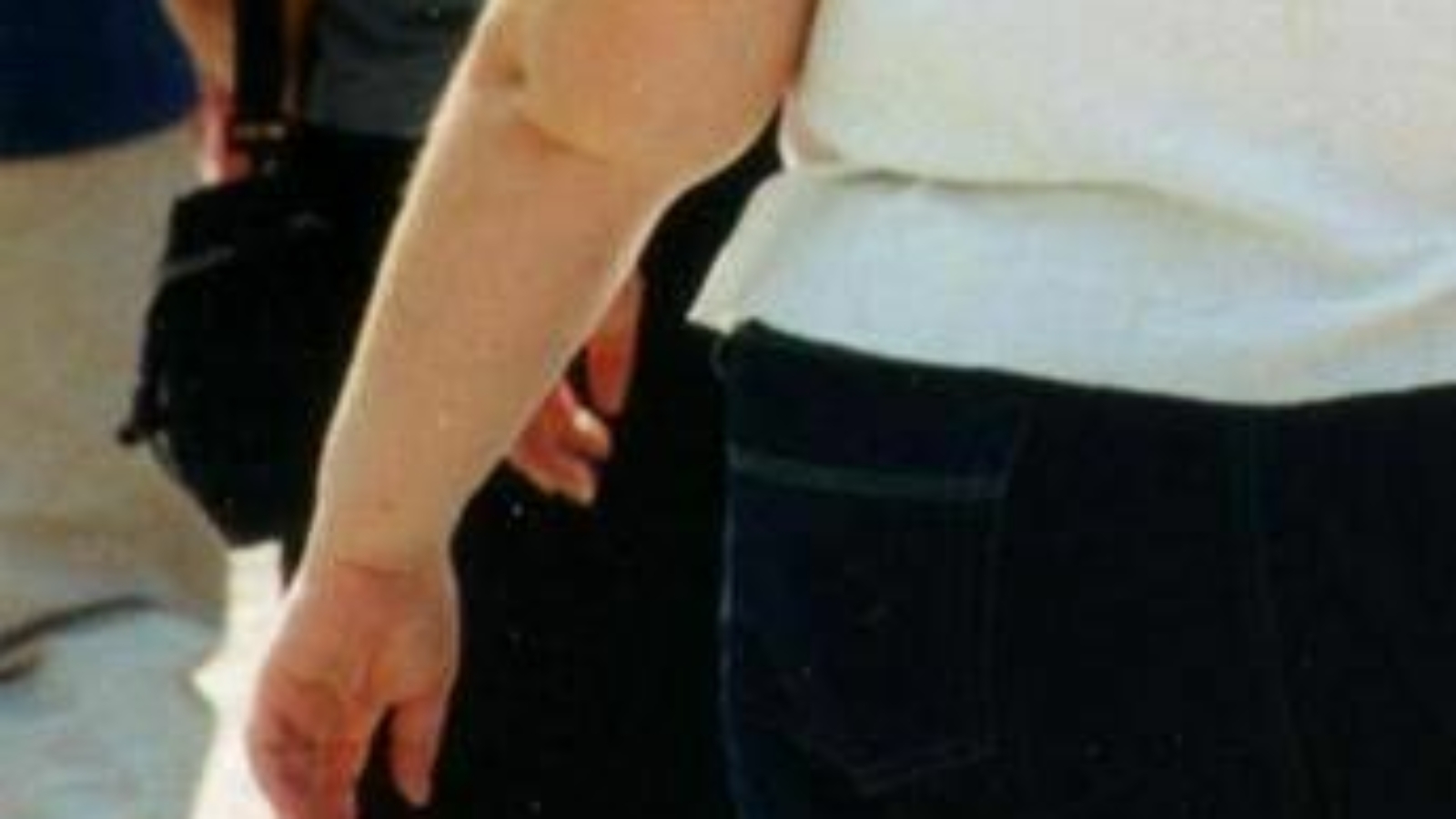 Una morte per malattie infettive su 10 è legata all'obesità, lo studio