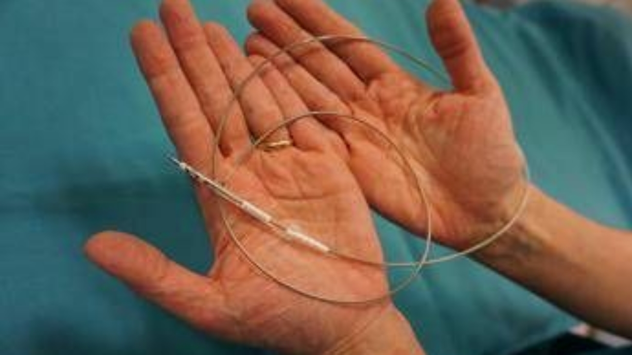 Medicina, 'filo' sottile 1,5 mm contro morte cardiaca improvvisa, a Bergamo primi interventi