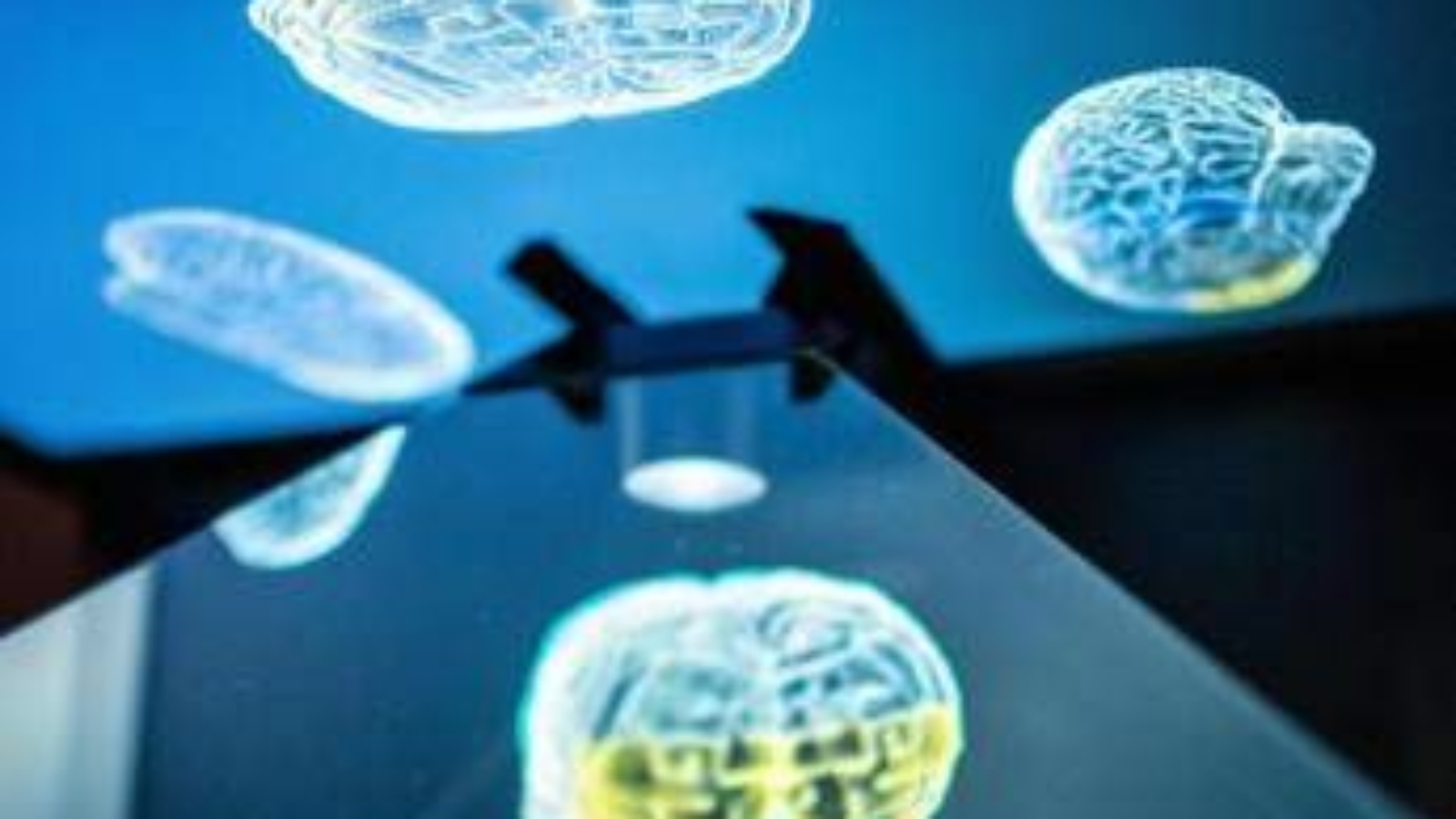 Ictus, ecco come l'emisfero sano del cervello influenza la ripresa: la ricerca rivoluzionaria