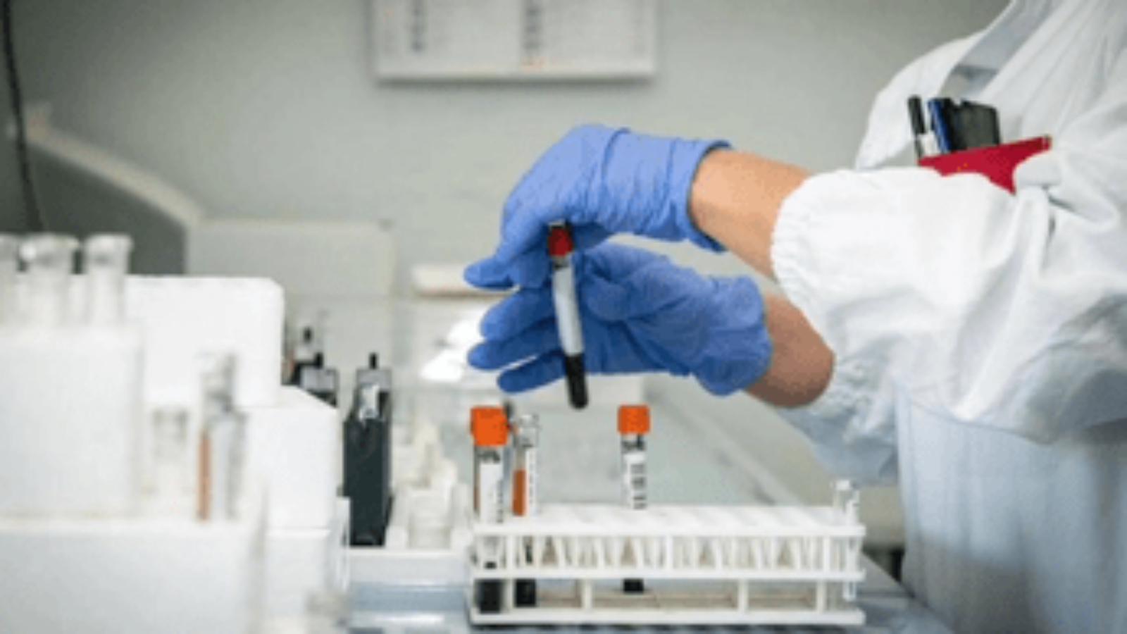 Alzheimer, allo studio nuovo test del sangue per diagnosi precoce