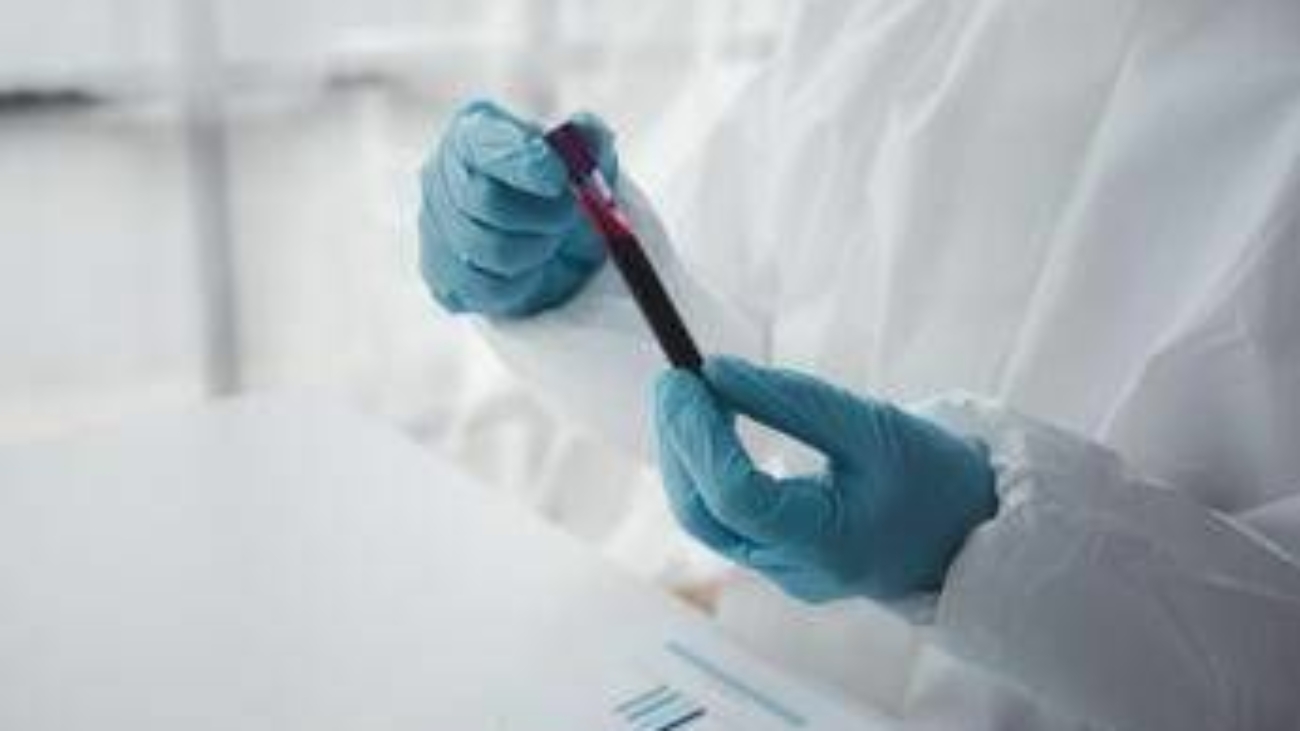 Epatite A in forte crescita in Italia: Lazio, Campania e Puglia le regioni con più casi