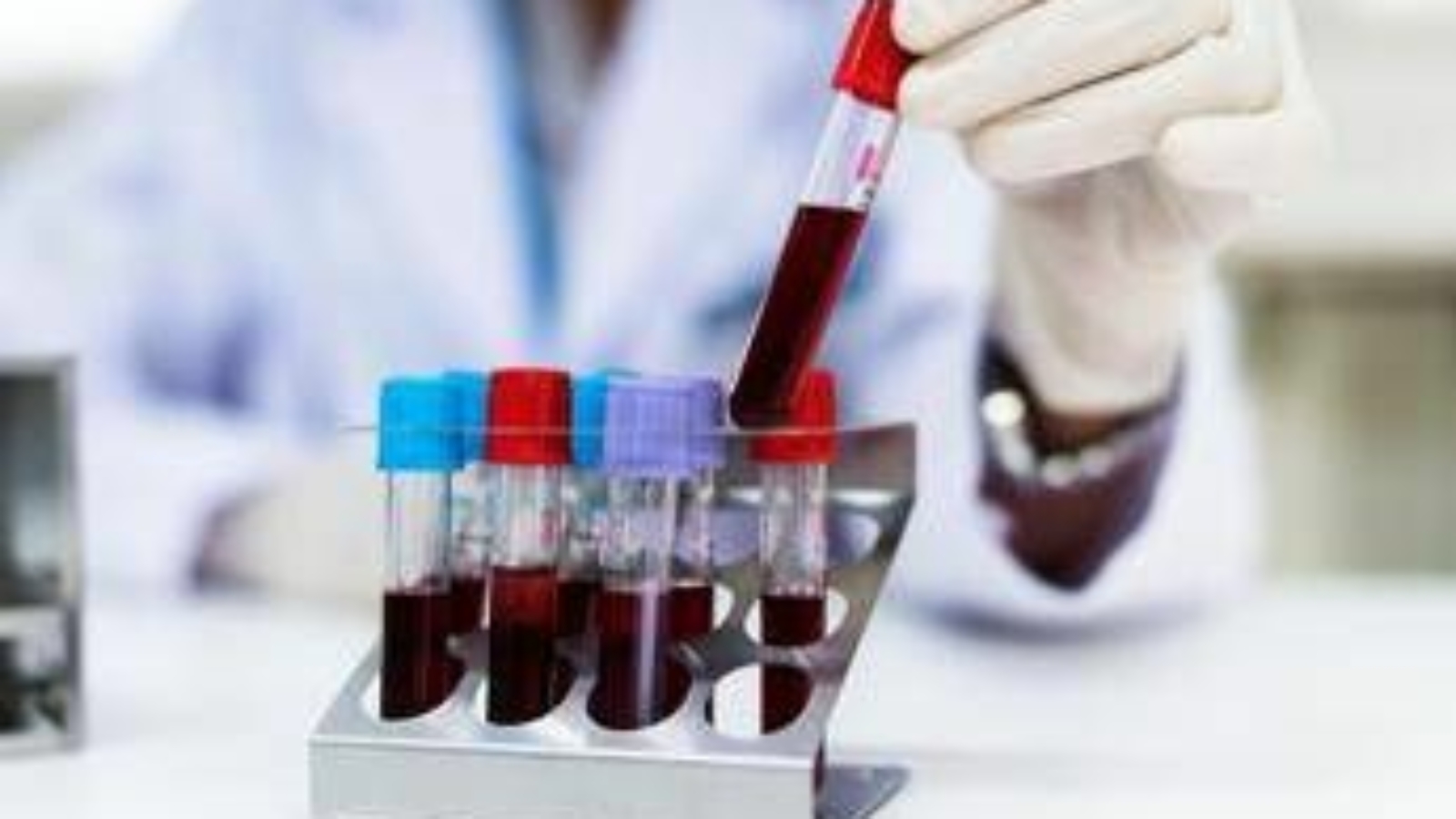 Aviaria, cos'è il virus H9N2: come si trasmette e i rischi per l'uomo