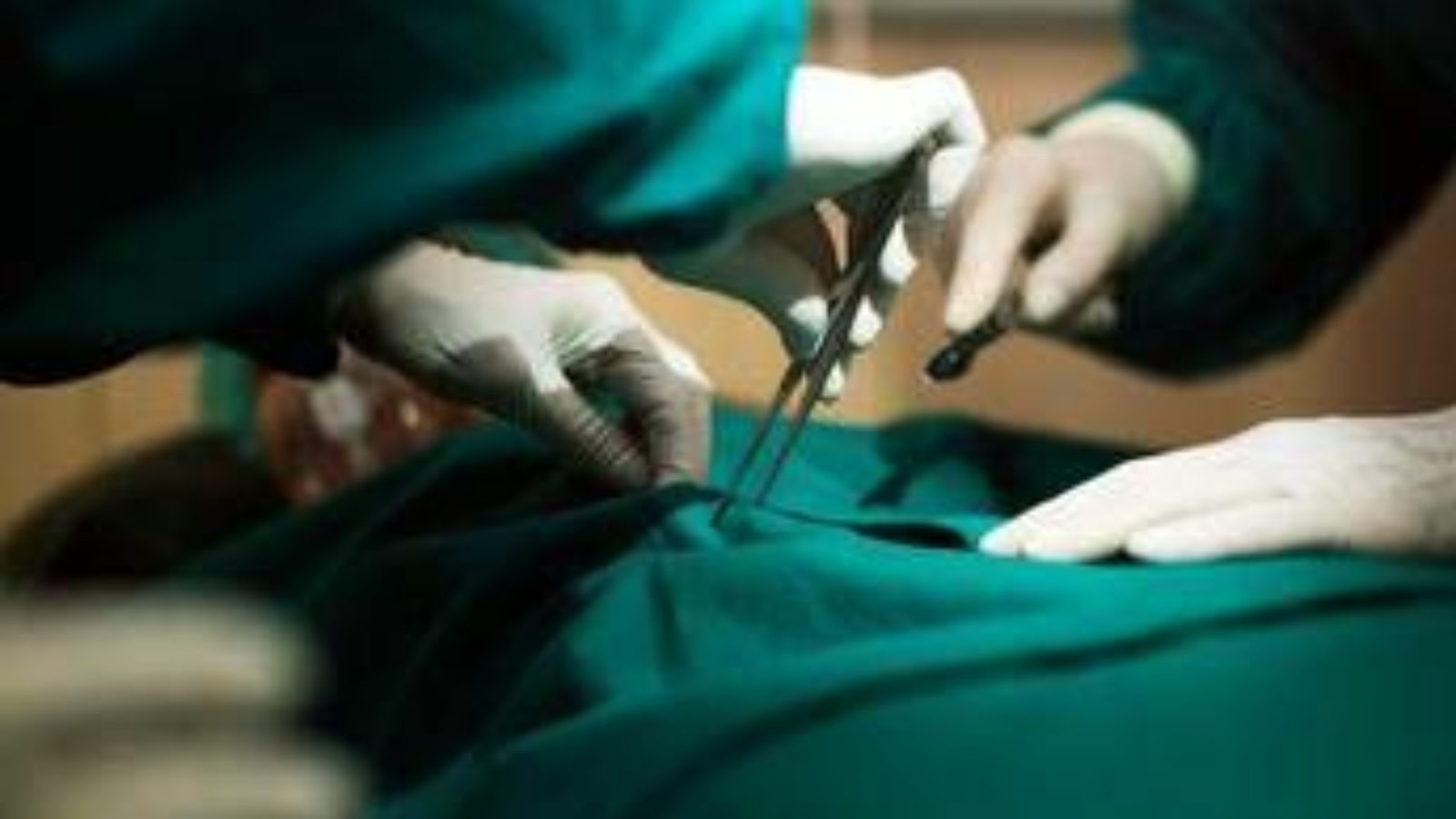 Trapianti, in Italia numeri in crescita: "2025 anno migliore di sempre"