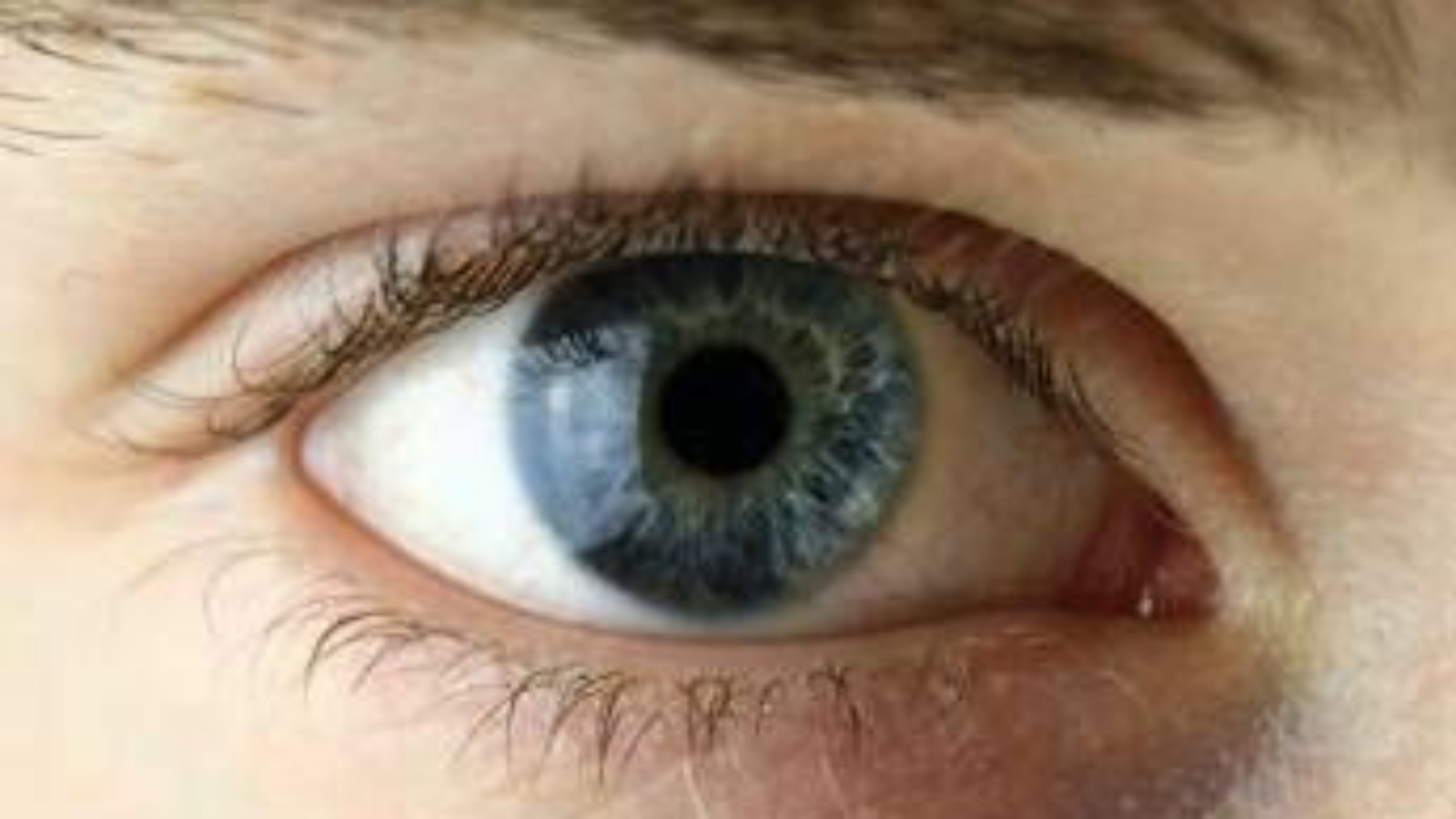 Chirurgia vitroretinica, al Miulli di Bari formazione sulla gestione dei casi complessi