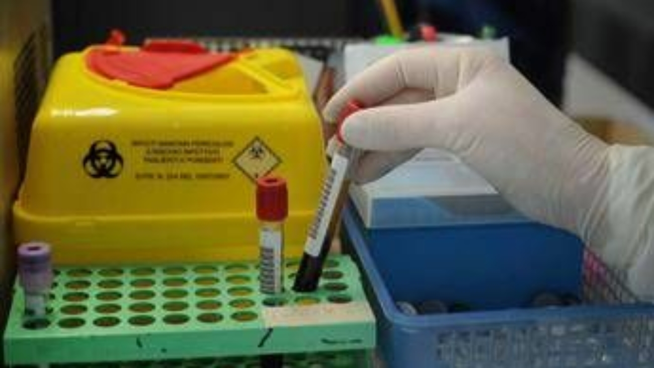 Tumori, nuovo test del sangue 'low cost' promette di scoprire diversi tipi di cancro