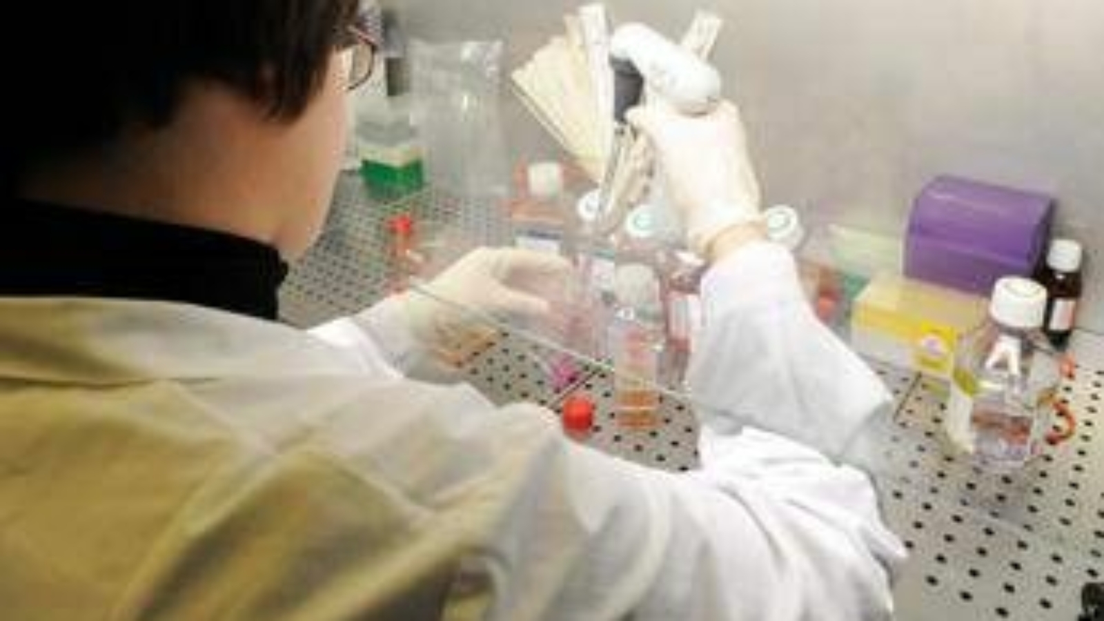 Bimbi Down da mamme giovani? Dietro la sindrome anche una reazione autoimmune: lo studio che cambia tutto